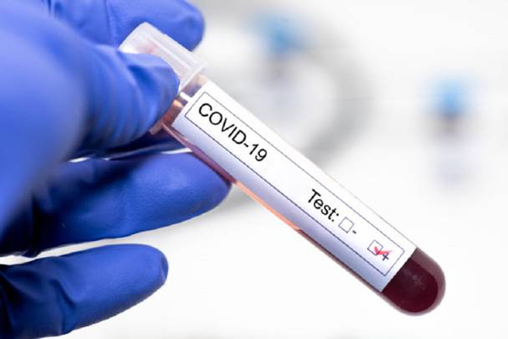 Sanidad registra un nuevo caso de COVID-19 en las últimas 24 horas en El Hierro
